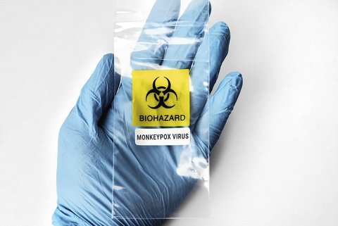 Blue-gloved hand holding plastic that says "biohazard monkeypox virus"